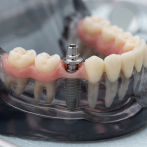 Multi-unit abutment and accessory-Straumann/ITI BLT